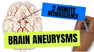 2Minute Neuroscience Brain Aneurysms [upl. by Schonfeld]