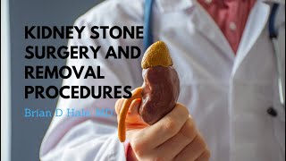 Kidney Stones 101 Everything You Wanted To Know  3D Guide [upl. by Nelyaw]