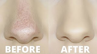 HOW TO STOP FOUNDATION RUBBING OFF YOUR NOSE  OILY SKIN TRICKS [upl. by Ahsetal]