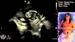 Obstetric Ultrasound Basics with Fetal Heart Rate Calculation​  Made Simple [upl. by Palocz]