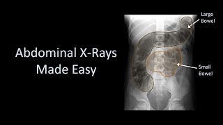 CT Cross Sectional Anatomy Abdomen Axial View [upl. by Yob]