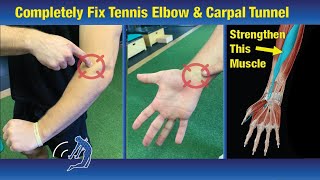 Fix Tennis Elbow in One Week  Exercises that Actually Work [upl. by Saleem]