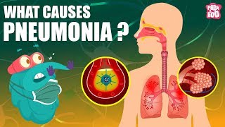 PNEUMONIA  What Is PNEUMONIA  Respiratory Disease  The Dr Binocs Show  Peekaboo Kidz [upl. by Ilahtan]