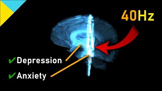 The 40Hz quotMIRACLEquot Repair Frequency for Depression amp Anxiety [upl. by Ribaj402]