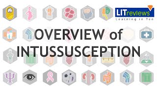 Overview of Intussusception [upl. by Zaria]