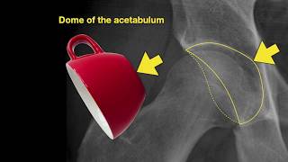 Anatomy of Hip Xrays [upl. by Eirised]