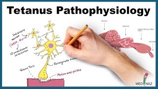 Tetanus Pathophysiology Mechanism of Action [upl. by Hsinam]