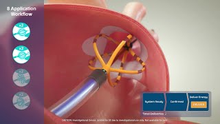 FARAPULSE™ Pulsed Field Ablation System Animation [upl. by Novah64]