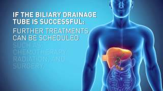 Biliary Drain [upl. by Durward815]