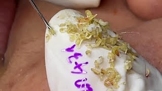 Satisfying With Loan Nguyen Spa Video 019 [upl. by Arno773]