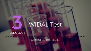 Widal test [upl. by Abrahamsen560]