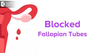 Blocked Fallopian Tubes Symptoms Fertility Issues amp Treatment  Dr Jyothi Patil  Doctors Circle [upl. by Desma212]