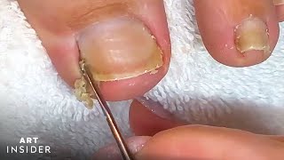 How Toenails Are Professionally Cleaned [upl. by Innos325]