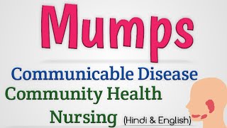 Mumps Treatment in Urdu  Kan Peray Ka ilaj [upl. by Ieluuk]