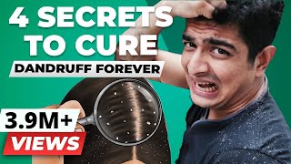 4 SECRET Tips To Remove Dandruff Forever  BeerBiceps Health [upl. by Ledah]