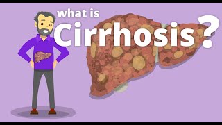 Cirrhosis  What is cirrhosis [upl. by Dloreg]