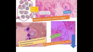 Most common Blood parasites [upl. by Eirovi]