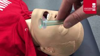 Nasopharyngeal Airway Insertion [upl. by Damali850]