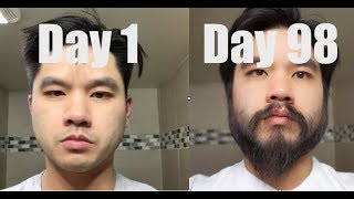 I Grew Out My Beard For 3 Months Using Minoxidil Rogaine [upl. by Eciral172]