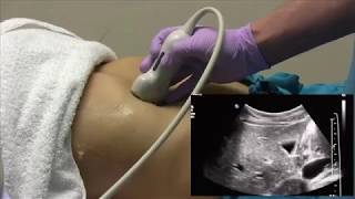 How I do it Ultrasound of the Abdomen [upl. by Ama]