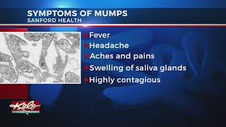 Mumps Symptoms Treatment  Parotid Swelling  Parotitis  Pediatrics [upl. by Reginauld714]