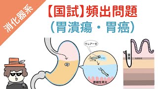 【国試対策】胃の疾患（胃潰瘍・胃がん・ダンピング症候群） [upl. by Bunde242]