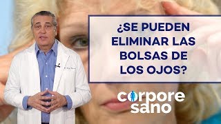 ¿Cómo puedo eliminar las bolsas de los ojos [upl. by Selokcin592]