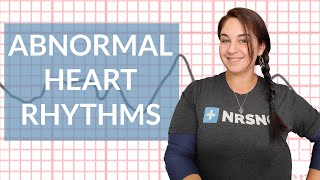 EKG like a BOSS Part 3  Abnormal Heart Rhythms [upl. by Gavra930]