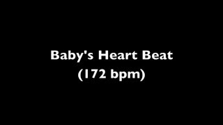 Fetal Heart Beat Audio 11 Weeks Pregnant [upl. by Llehsor838]