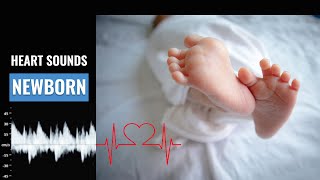 Newborn heart beat sound  How to calculate NB Heart rate  Normal NB Heart sound  Christina NP [upl. by Cryan]