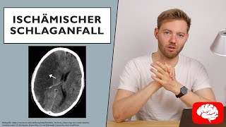 Ischämischer Schlaganfall  Grundlagen der Neurologie [upl. by Scrope]