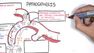 Malaria Pathophysiology [upl. by Elleirb273]