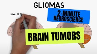 2Minute Neuroscience Brain tumors [upl. by Bozovich]