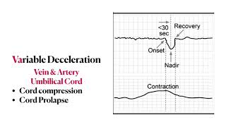 Fetal heart rate tracing  Mnemonics Concepts amp Management  High yield review [upl. by Bekah]