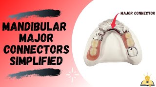 Mandibular Major Connectors  Removable Partial Denture RPD [upl. by Tnattirb864]