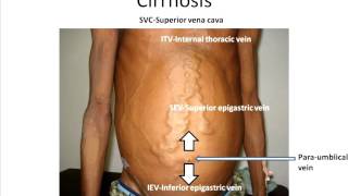 How to interpret an abdominal CT [upl. by Auberta]