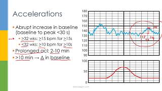 Learn OBGYN Fetal Heart Rate Monitoring  Nonstress Test [upl. by Norse]