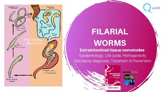 Filarial worms Wuchereria bancrofti Brugia malayi Mansonia Loa loa Onchocerca volvulus ampmore [upl. by Blandina]