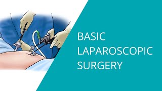 Basic Laparoscopic Surgery [upl. by Yroj]