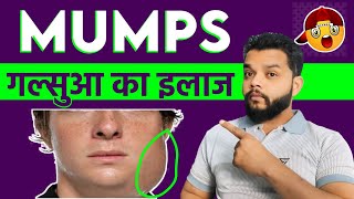 Mumps Causes Symptoms Treatment  Mumps [upl. by Lekym]