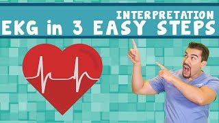 EKG interpretation  PQRST memory Trick  in 3 easy steps Part 2 [upl. by Elery266]