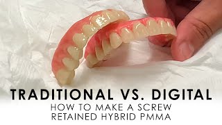 Traditional vs Digital How to make Screw Retained Hybrid PMMA [upl. by Tolland321]