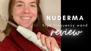 NuDerma High Frequency Wand Review [upl. by Battat209]