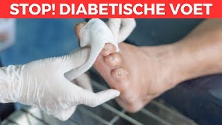 5 Symptomen Van Een Diabetische Voet  Tips Voor Een Behandeling [upl. by Aserret269]