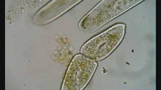 Paramecium Dividing [upl. by Oribelle607]