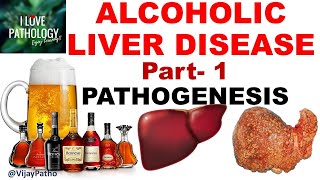 ALCOHOLIC LIVER DISEASE Part 1 Pathogenesis [upl. by Ettennej]