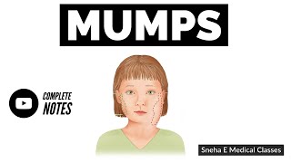 Mumps Symptoms Causes Treatments and Complications [upl. by Adnana]