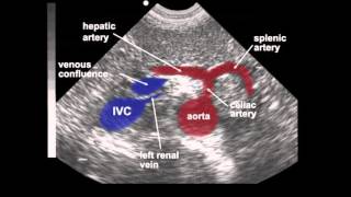 Abdominal Xray Interpretation for Medical Students [upl. by Ahseyd463]